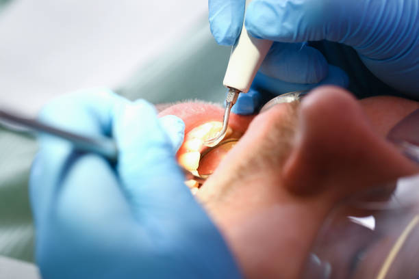 Best Emergency Tooth Extraction  in Pistakee Highlands, IL
