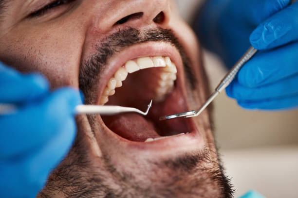 Best Dentist for Dental Trauma  in Pistakee Highlands, IL