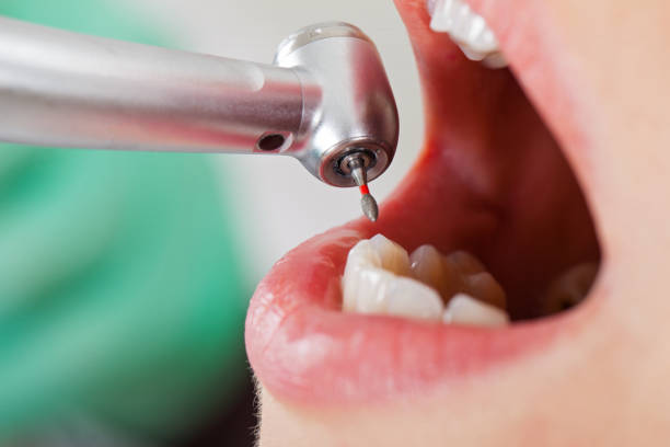 Best Emergency Gum Pain Relief  in Pistakee Highlands, IL